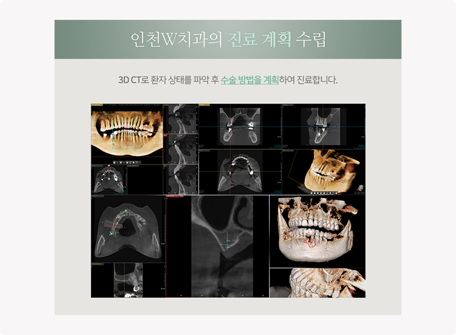 치료전후사진07